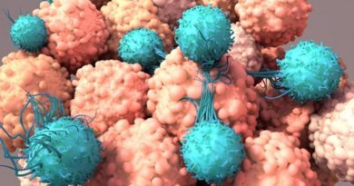 Descubren cómo prevenir el agotamiento de las células T, claves en la lucha contra el cáncer