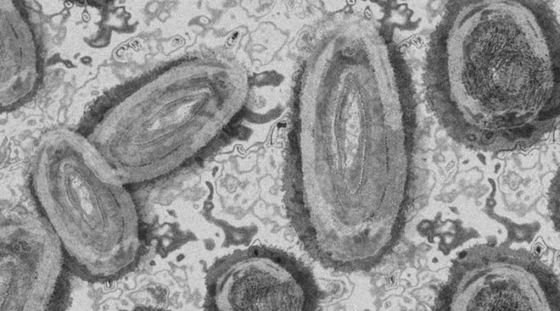 El virus de la viruela del mono ha mutado para adaptarse a los humanos: estudio en Nature