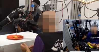 Hombre con parálisis controla brazos robóticos con la mente