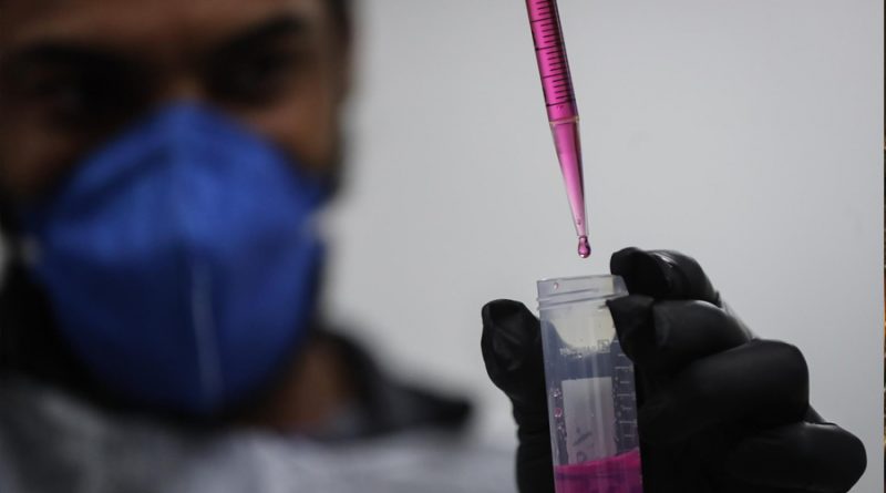Una nueva forma de vacuna intranasal crea anticuerpos para el VIH y la covid
