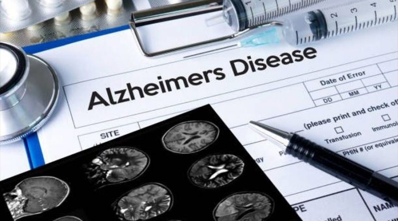 Crean sensor que identifica signos de Alzheimer hasta 17 años antes