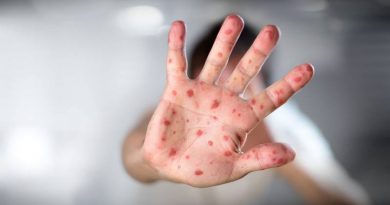 La vacuna contra viruela del mono tarda semanas en inmunizar, indica la OMS