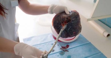 Ritual, peligro y ciencia: comer placenta, la práctica que está en el foco de la medicina