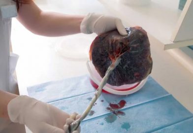 Ritual, peligro y ciencia: comer placenta, la práctica que está en el foco de la medicina