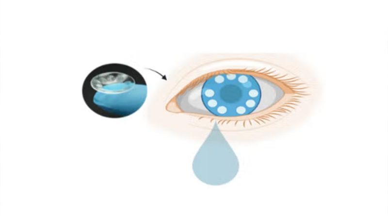 Científicos crean lentes de contacto inteligentes que 'diagnostican el cáncer'