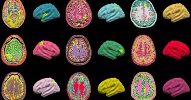 Desarrollan un algoritmo de IA que detecta anomalías cerebrales y podría ayudar a curar la epilepsia