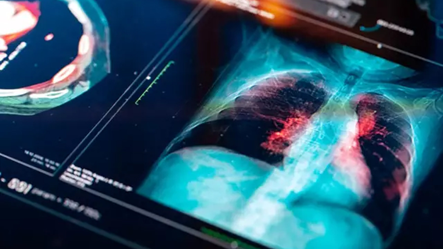 Científicos crean un nuevo componente para tratar lesiones pulmonares
