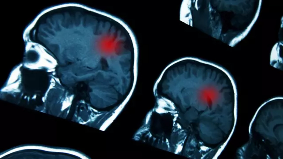 Descubren un gen en ratones que puede reducir el daño cerebral en los recién nacidos