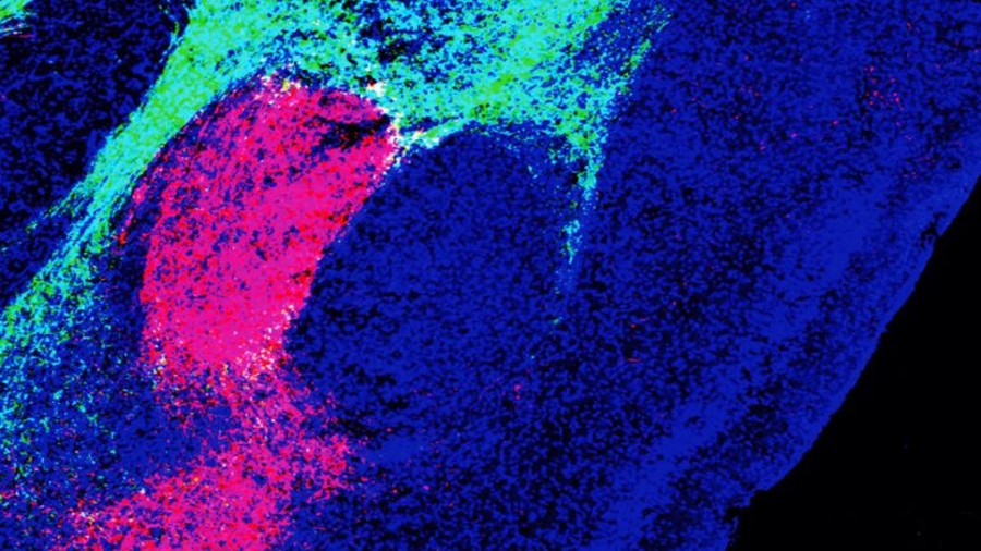 Científicos descubren molécula que da origen al miedo en el cerebro