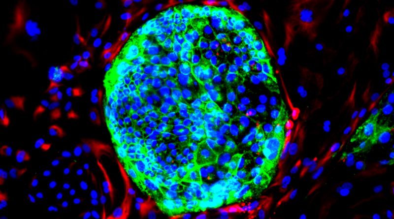 Crean un nuevo tipo de célula humana para la investigación embrionaria