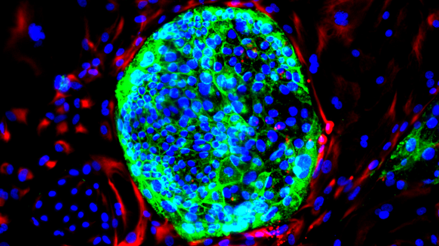 Crean un nuevo tipo de célula humana para la investigación embrionaria