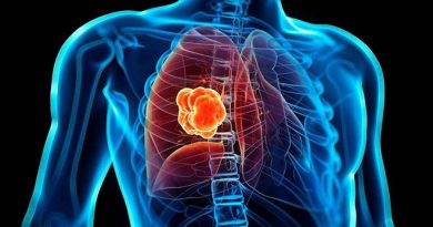 Combinación de dos fármacos detiene el cáncer de pulmón más mortal, según estudio
