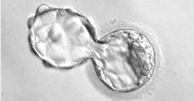Crean un nuevo tipo de célula humana para la investigación del desarrollo embrionario