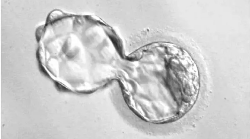 Crean un nuevo tipo de célula humana para la investigación del desarrollo embrionario