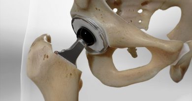 Investigadores mexicanos desarrollan un material similar al hueso para prótesis