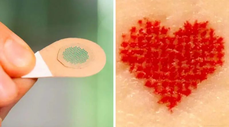 Los tatuajes indoloros podrían ser una realidad gracias a estas agujas microscópicas llenas de tinta