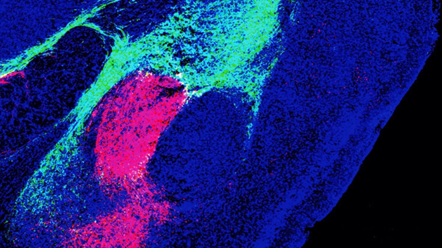 Una sola molécula cerebral decide si sufrimos o disfrutamos