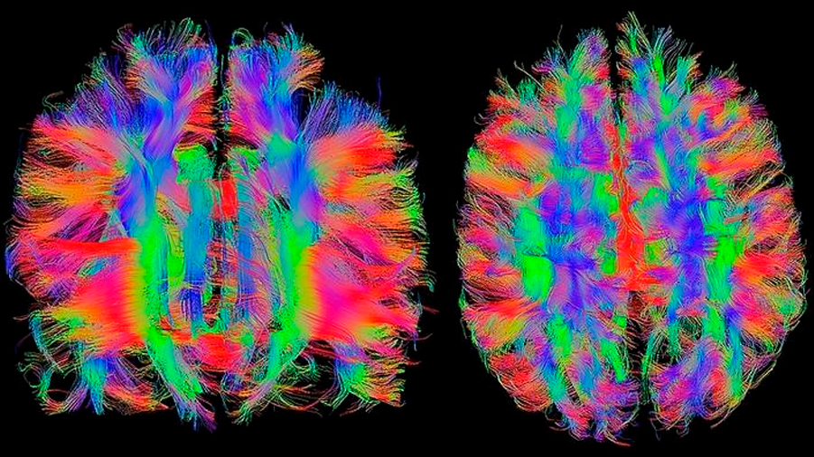 Las imágenes del cerebro pueden revelar lo que está pensando una persona
