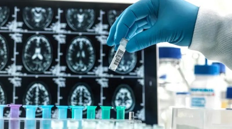 Fármaco experimental frena 27% el deterioro cognitivo en personas con Alzheimer