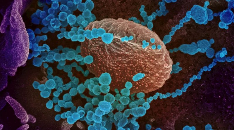 cómo el coronavirus SARS-CoV-2 se comunica con las células humanas