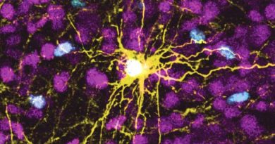 Científicos implantan células humanas en el cerebro de ratas y logran conexiones neuronales