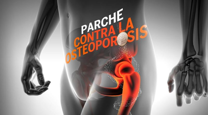 Estudiante mexicana crea parche para tratar osteoporosis