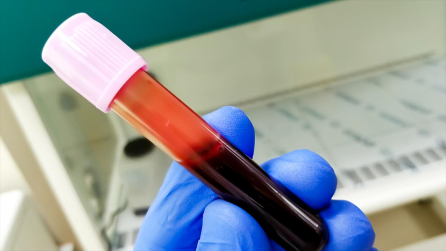 Sistema Er: la sangre que ayudará a salvar vidas de futuros recién nacidos