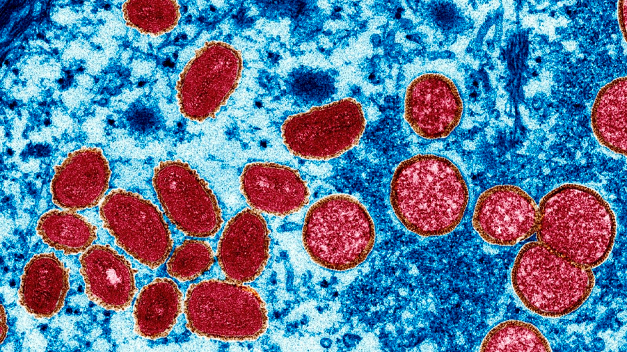 Estas son las mutaciones de la viruela del mono que hacen al virus infeccioso