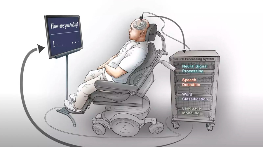 Una neuroprótesis que transcribe el pensamiento a 30 letras por minuto