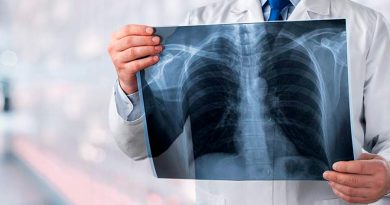 UNAM crea prueba para detectar cáncer de pulmón por medio del aliento