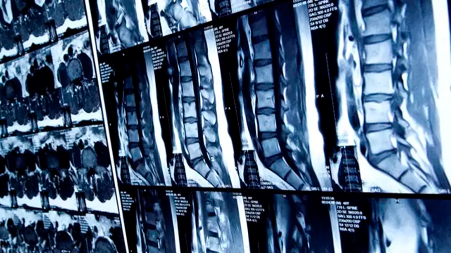 Descubren nuevas y sorprendentes funciones de la médula espinal y el tronco cerebral en el tacto