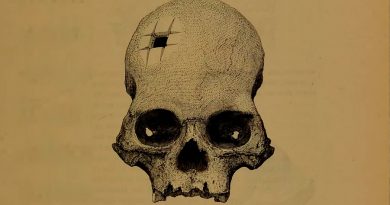 Un cráneo con un agujero perfecto confirma que los incas realizaban con éxito complejas cirugías