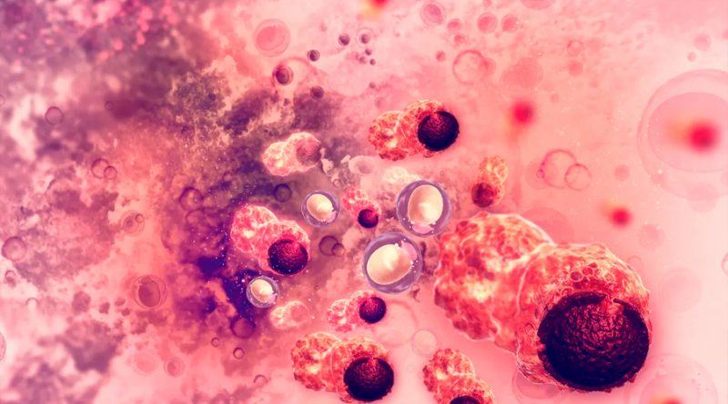 Un nuevo análisis de sangre es capaz de detectar más del 80% de los cánceres de hígado