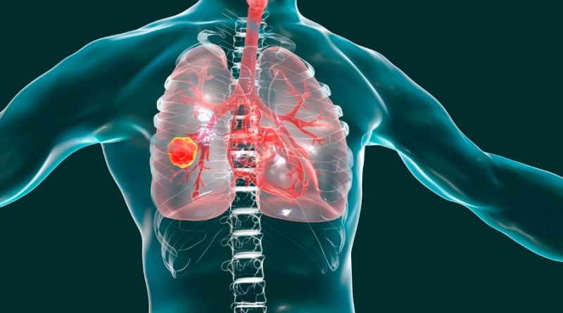 Un estudio describe 144 tipos de células en el pulmón y sus interacciones