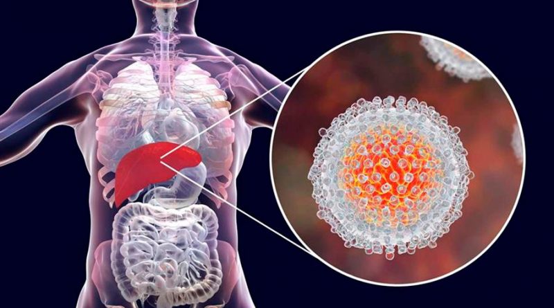 Un biosensor de grafeno permite la detección ultrasnsible de la hepatitis C