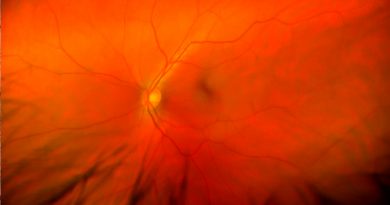 Investigadores usan bioimpresión 3D para crear tejido ocular y estudiar enfermedades de la vista