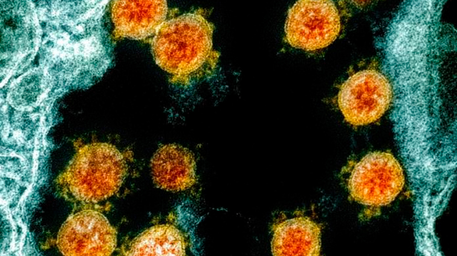 Descubren 100,000 nuevos tipos de virus ARN desconocidos por la ciencia