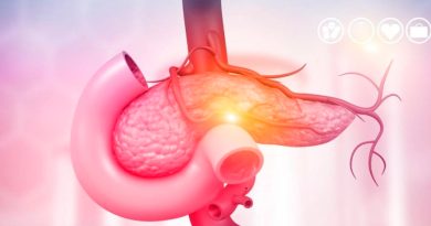 Investigadores estadounidenses descubren una triple combinación de inmunoterapia para abordar el cáncer de páncreas