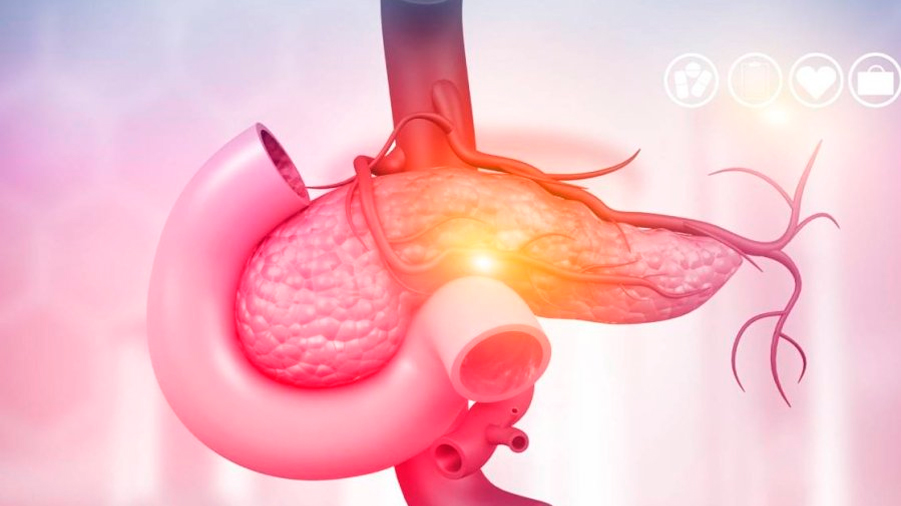 Investigadores estadounidenses descubren una triple combinación de inmunoterapia para abordar el cáncer de páncreas