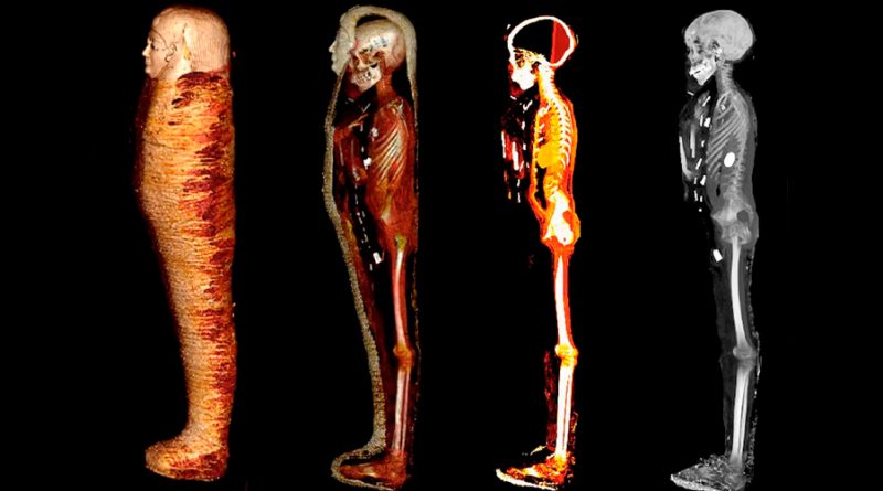 Escáneres revelan 49 amuletos ocultos en el cuerpo de esta momia perteneciente a un niño
