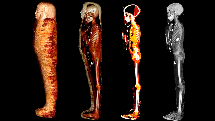 Escáneres revelan 49 amuletos ocultos en el cuerpo de esta momia perteneciente a un niño