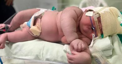 Nace un 'bebé gigante' de 7,3 kg en Brasil: cuáles son las causas y los riesgos de la macrosomía
