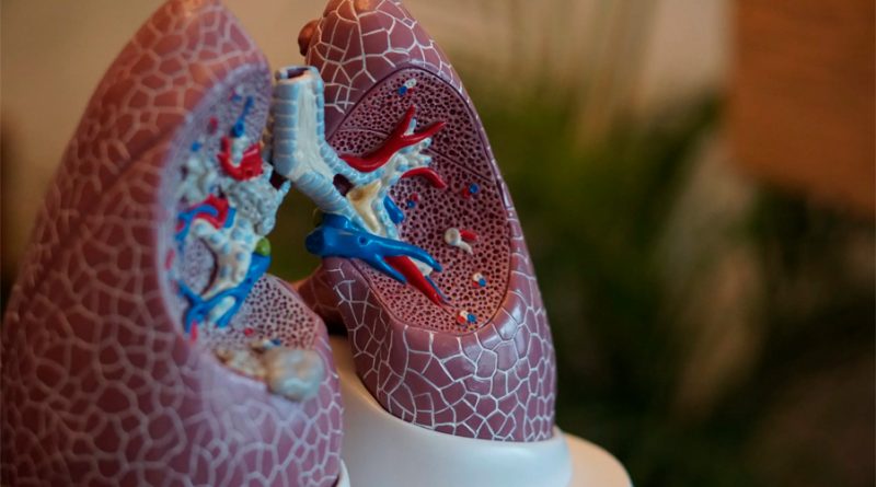 Una molécula para tratamiento contra el cáncer de pulmón llega a México