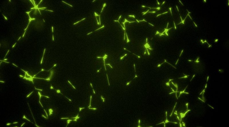Un estudio muestra cómo una bacteria causante de neumonías extrahospitalarias consigue sobrevivir