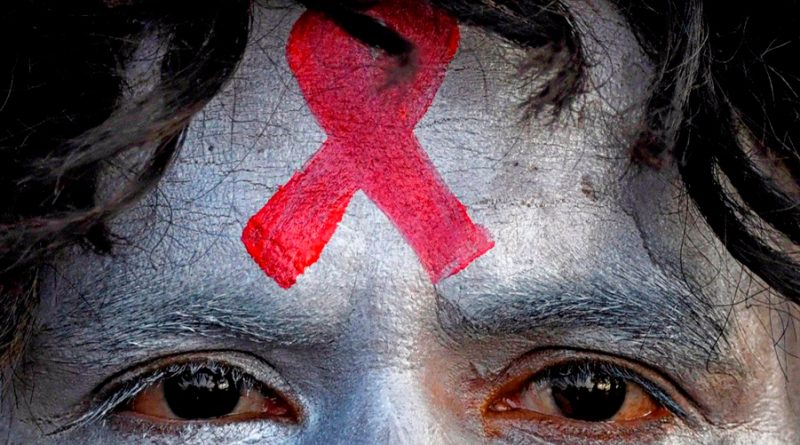 Similitudes y diferencias de los tres casos de curación de VIH: tratamientos muy agresivos y no para todos los pacientes