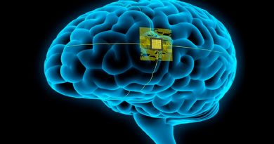 Implantan a siete pacientes chip cerebral que permite manejar dispositivos con la mente