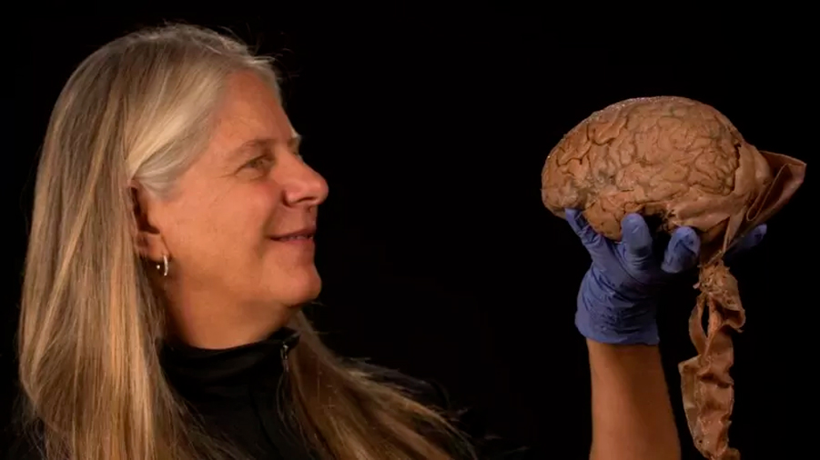 Por un derrame cerebral que la paralizó, científica hizo un gran descubrimiento