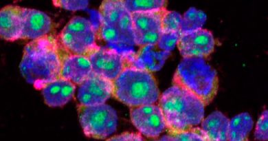 Desarrollan nanocápsulas para atacar tumores cancerosos