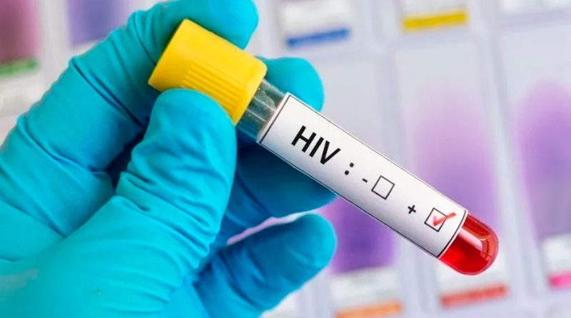 Científicos mexicanos desarrollan prueba que detecta VIH, VPH o Covid-19