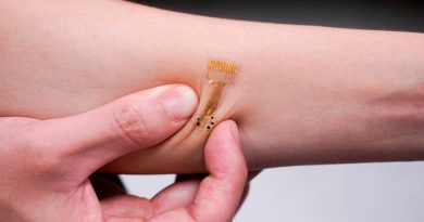 Crean parche bioelectrónico para curar heridas crónicas